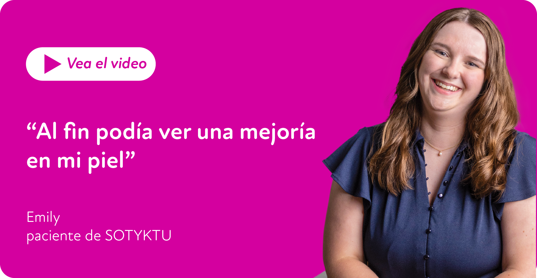 Emily es una paciente real de SOTYKTU que recibió compensación por su tiempo. Sus resultados pueden variar.